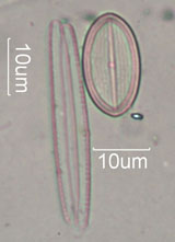 Diatom